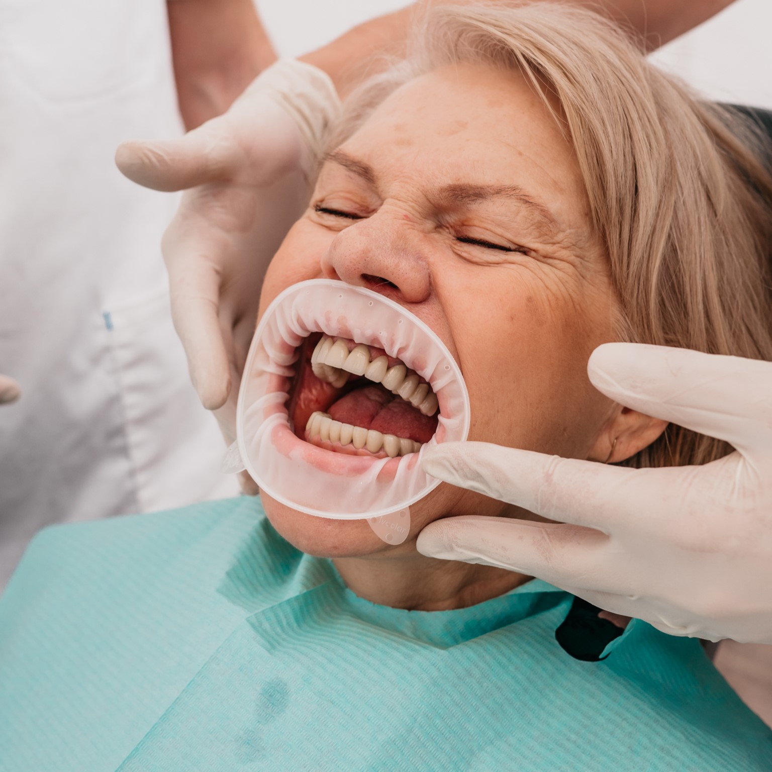 Blistav osmijeh — Dental Centar Apex